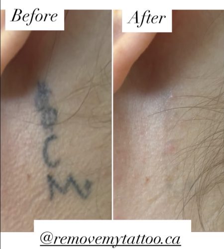 before and after